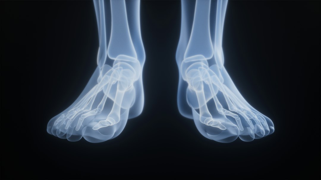 How Bone Spurs Develop in Joints: Signs, Causes, and When to Worry