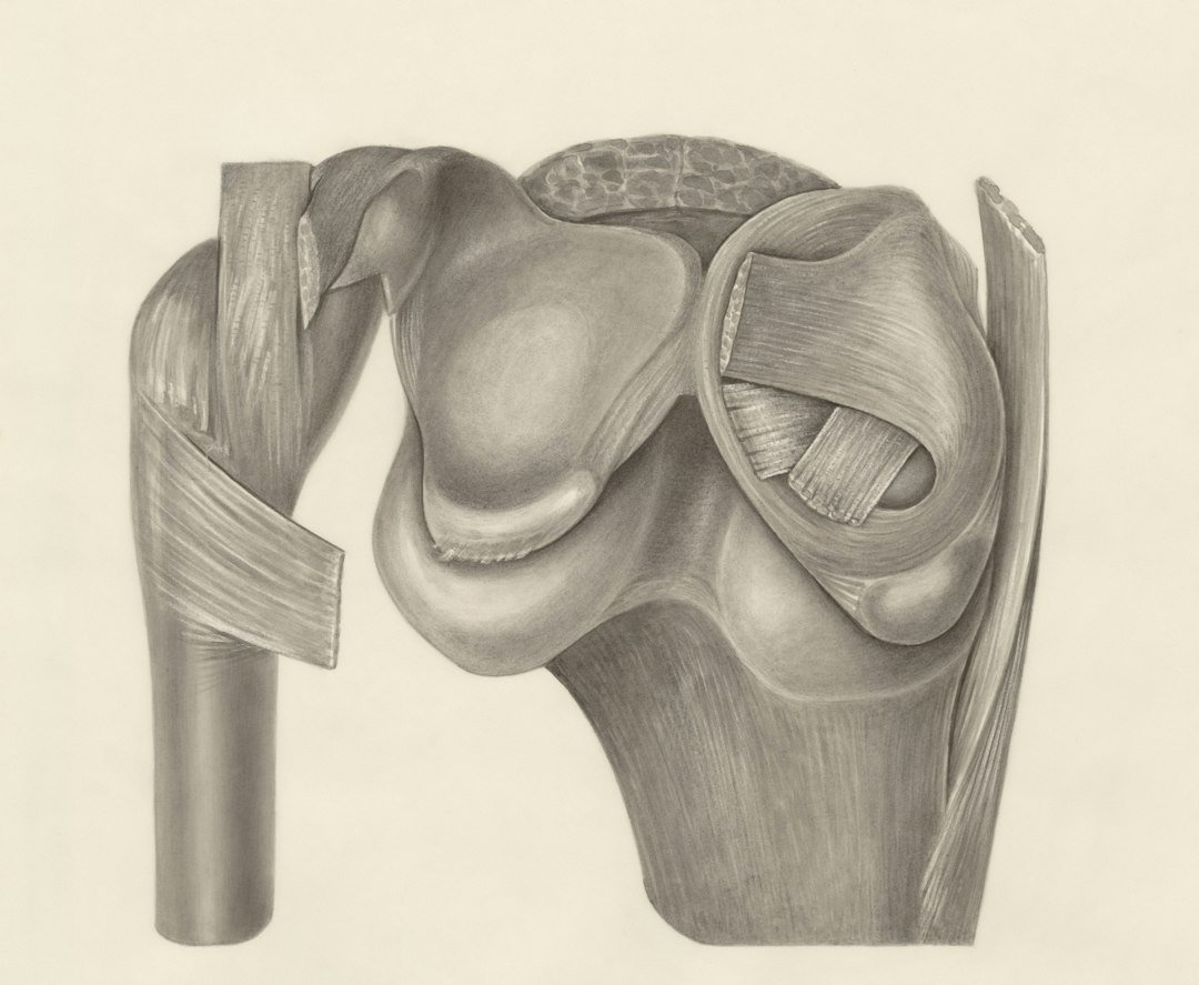 Why Does Cartilage Degeneration Cause Creaking and Popping in Joints